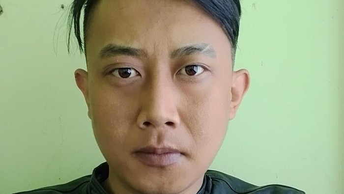 RSHS Ungkap Sejumlah Belatung Ditemukan di Kepala Wanita Korban Taufik Hidayat